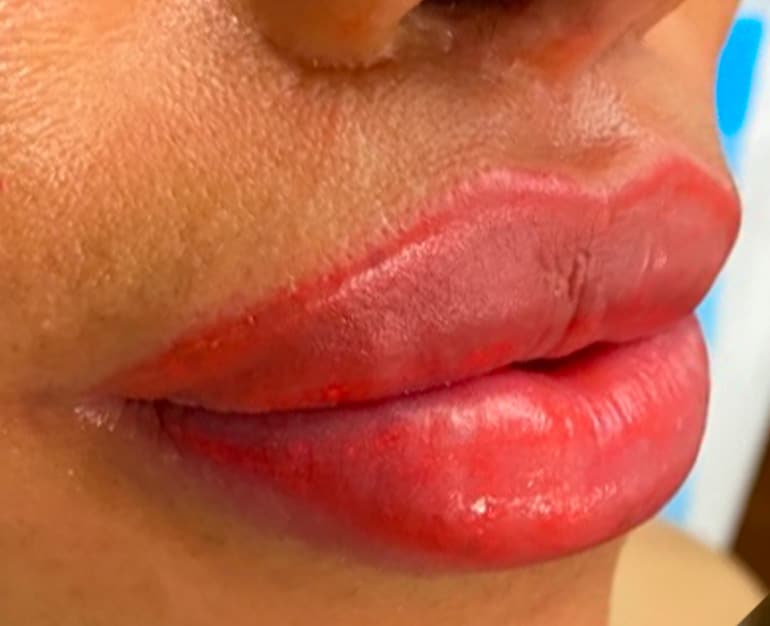 lip tint after 2 2